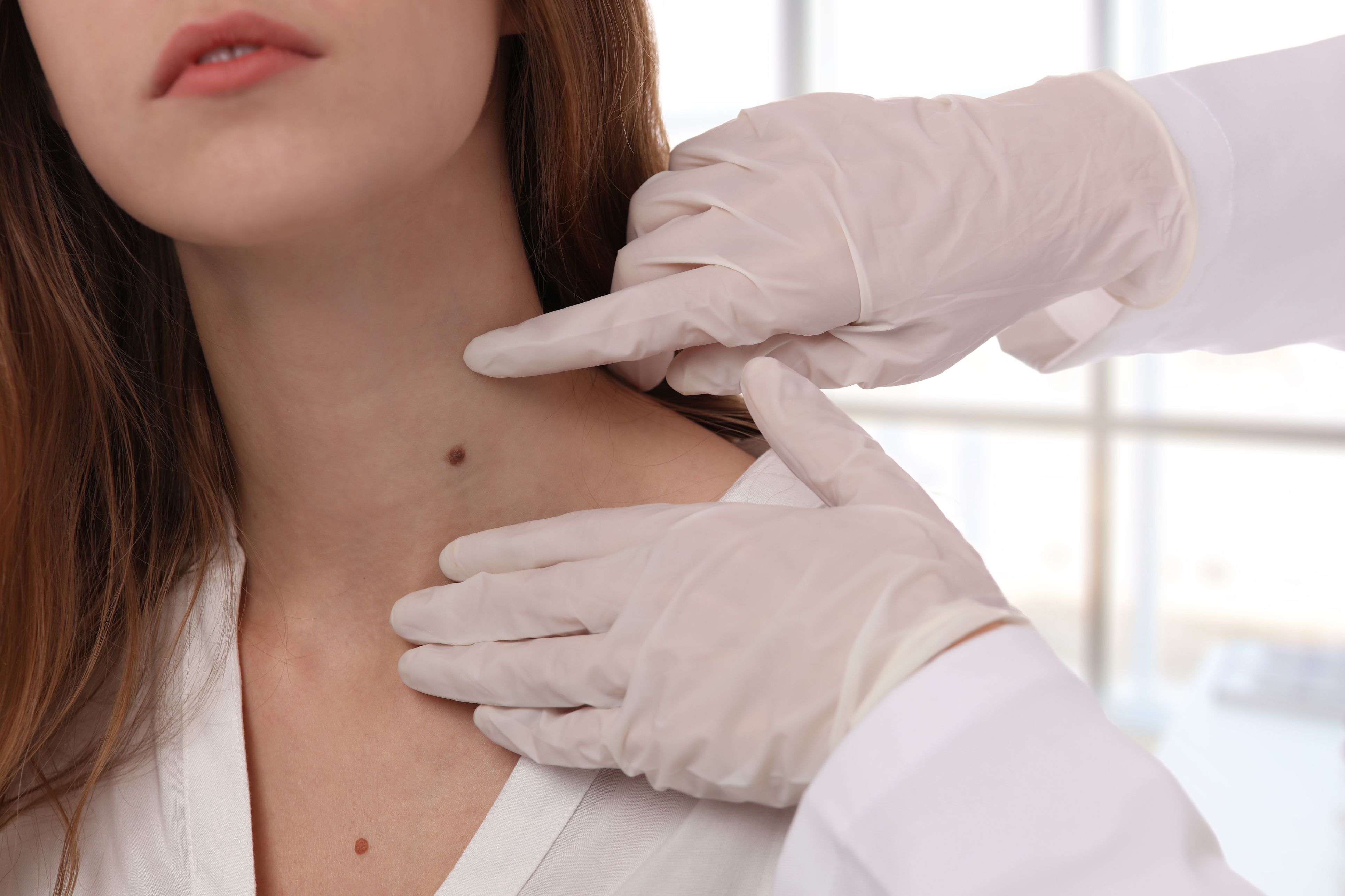 La startup Dermavision Solutions ha creat una cabina per detectar els melanomes | iStock La startup Dermavision Solutions ha creat una cabina per detectar els melanomes | iStock