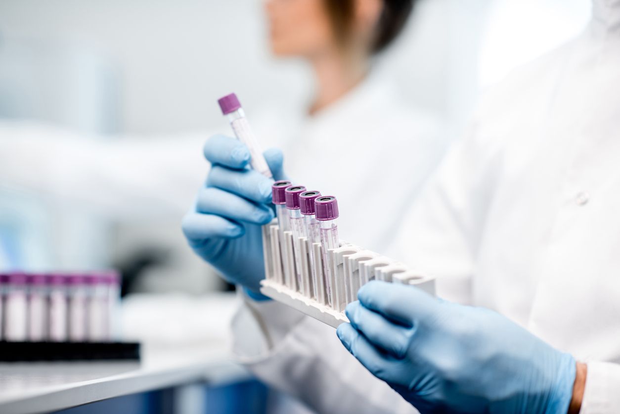Moirai Biodesign crea un prototip de kit de diagnòstic que permetrà detectar la sèpsia | iStock Moirai Biodesign crea un prototip de kit de diagnòstic que permetrà detectar la sèpsia | iStock