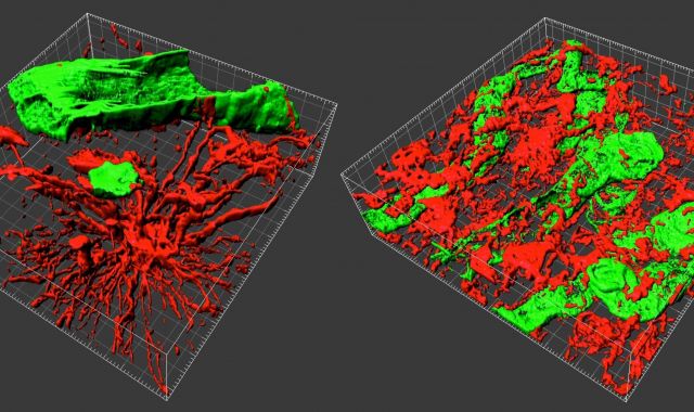 Imatges en 3D d'un càncer preses amb el sistema desenvolupat per investigadors de la UAB | Europa Press