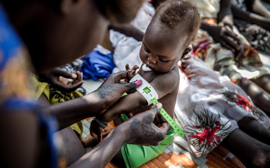 Mesurament del nivell de malnutrició d'un nen a un camp de refugiats d'Etiòpia | Fundació ”la Caixa”