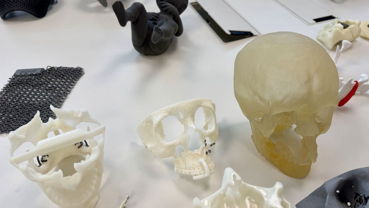 Prototips maxil·lofacials creats amb impressió 3D al 3D Incubator del CZFB | Gemma Sánchez Bonel (ACN) Prototips maxil·lofacials creats amb impressió 3D al 3D Incubator del CZFB | Gemma Sánchez Bonel (ACN)
